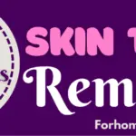 Quick & Easy Home Remedies for Skin Tags Removal